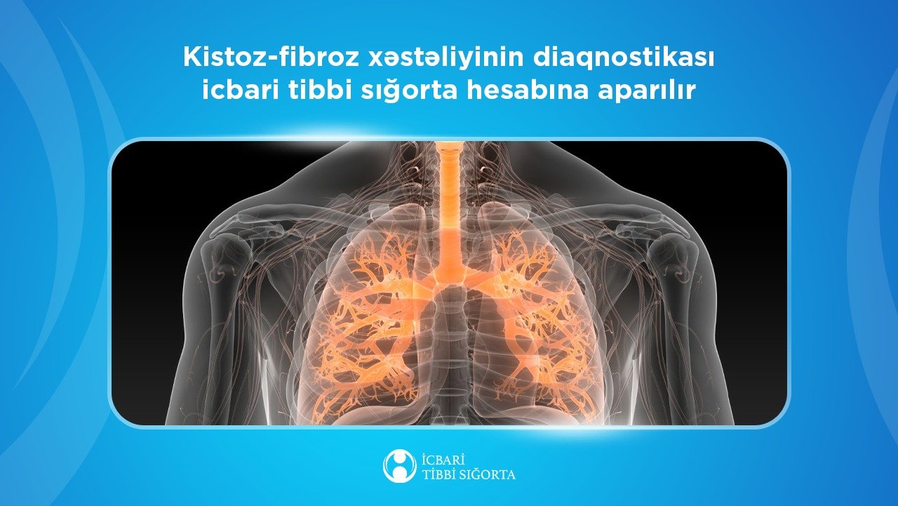 Kistoz-fibroz xəstəliyinin diaqnostikası icbari tibbi sığorta hesabına aparılır
