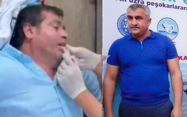 Araz Musayevin bıçaqlanmasına görə 5 nəfər saxlanıldı