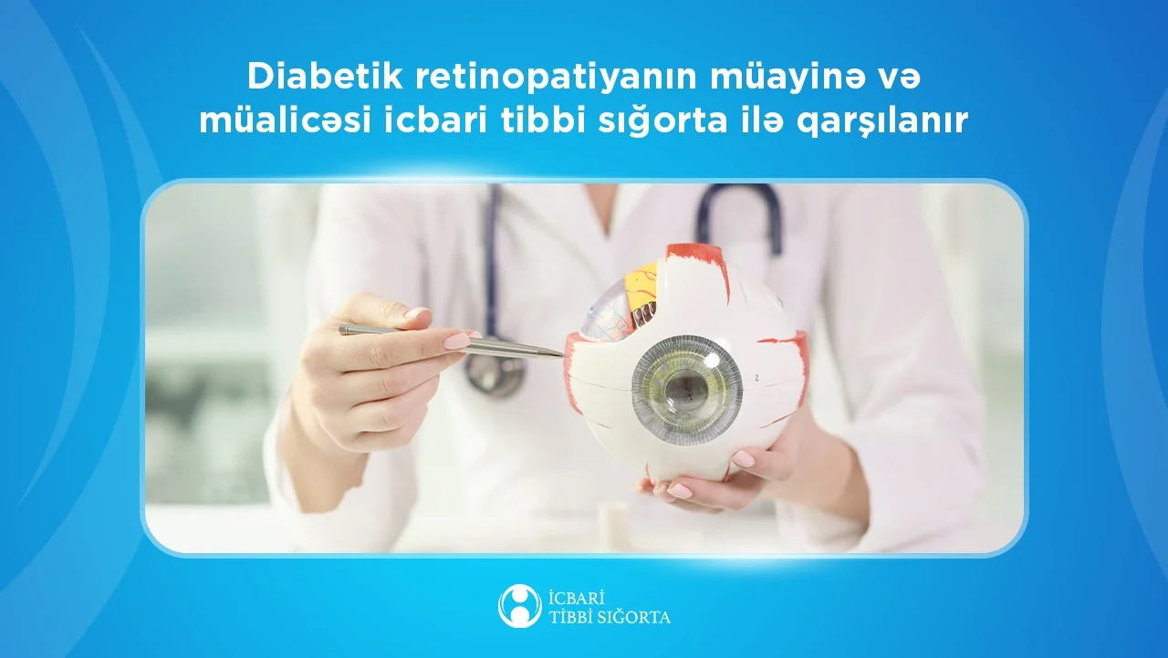 Şəkərli diabeti olan şəxslərdə daimi görmə itkisi yaradan  xəstəliyin müayinə və müalicəsi icbari tibbi sığorta ilə qarşılanır