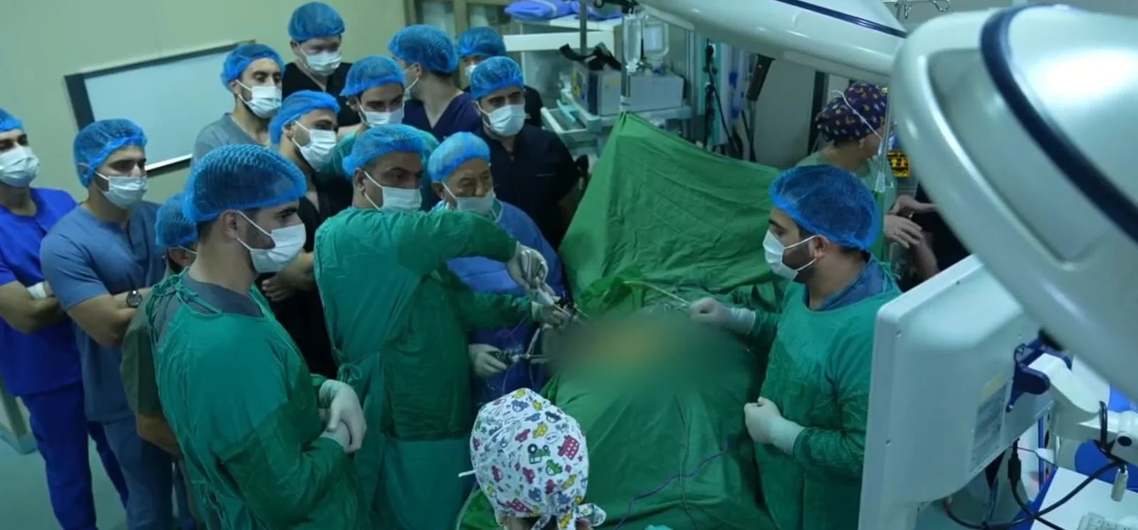 Səhiyyə Nazirliyinin klinikasında 7,5 sm-lik böyrəküstü vəz törəməsi laparoskopik üsulla çıxarılıb